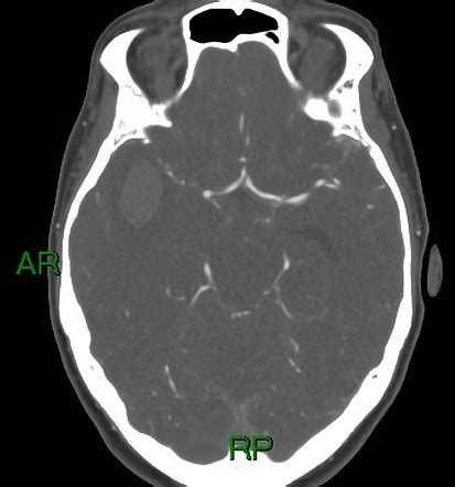 Image Radiopaedia Org