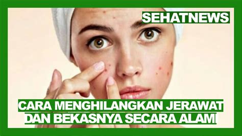 Cara Menghilangkan Jerawat Dan Bekasnya Secara Alami Youtube