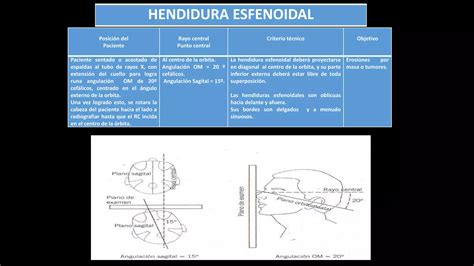 PROYECCIONES RADIOGRÁFICAS DE CRANEO PPT