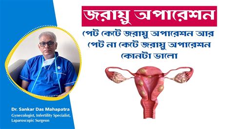 Laparoscopic Hysterectomy Vs Abdominal Hysterectomy Dr Sankar