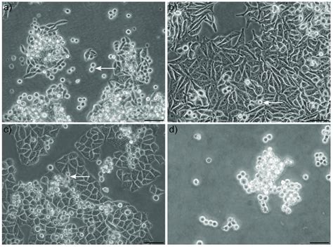 Morphology Of Adherent And Floating Tumor Cells Examples Of A Sw620