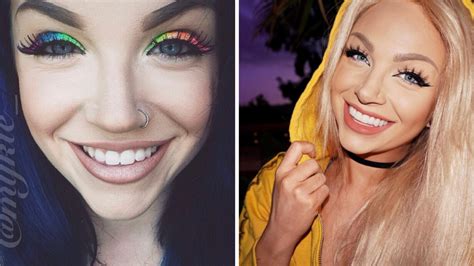 5 Celebrities with Veneers Who are Open About Their Experience