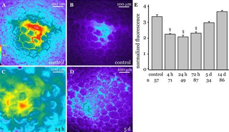 Microvessel Permeability In LPS Instilled Lungs Permeability Of Single