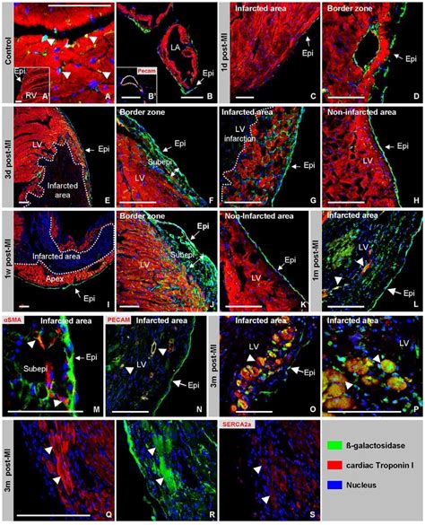 Post Ischemic Epicardial Lineage Analysis In Healthy Wt1 Cre X R26r Download Scientific