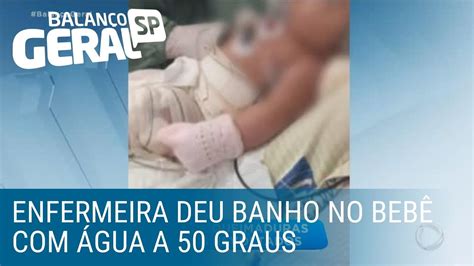 Beb De Seis Meses Sofre Queimaduras Durante Banho Em Hospital Do Rio