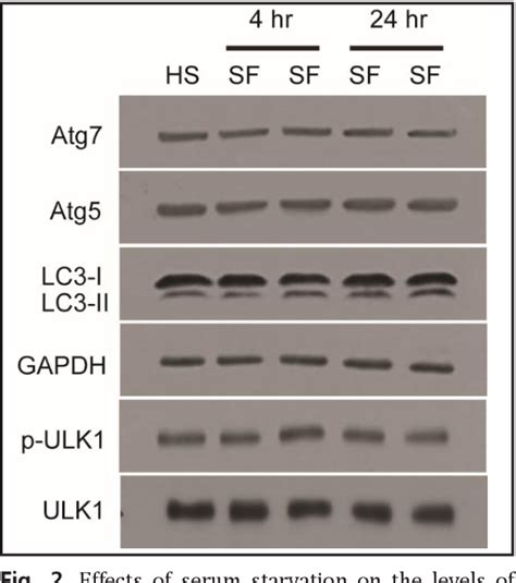 Figure 2 From Roles Of Exosome Like Vesicles Released From Inflammatory