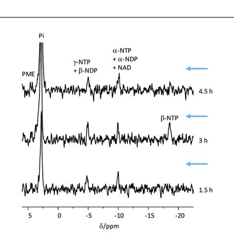 31 P Spectra Of Cos 31 P Nmr Spectra Acquired From Cos At 10 Weeks Download Scientific