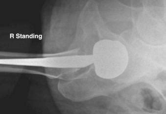 Hip Instability Clinical Tree