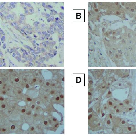 Immunohistochemical Determination Of Androgen Receptor Androgen