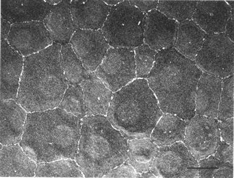 A Figure 1 Scanning Electron Micrographs Of The Diseased Human Corneal