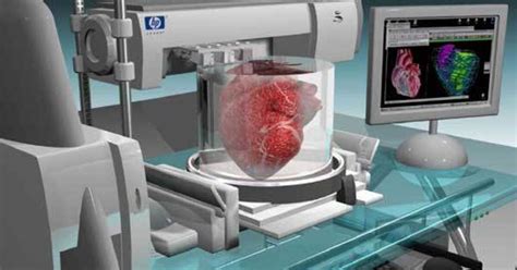 Impresión 3d Aplicada En Medicina