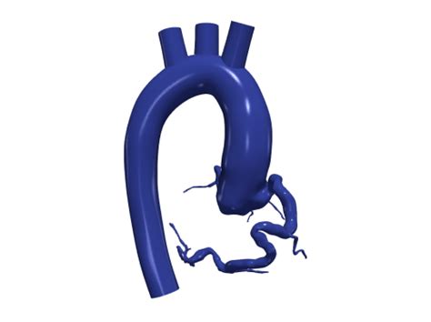 D Model Of Aorta And Coronary Arteries Aorta Embodi D