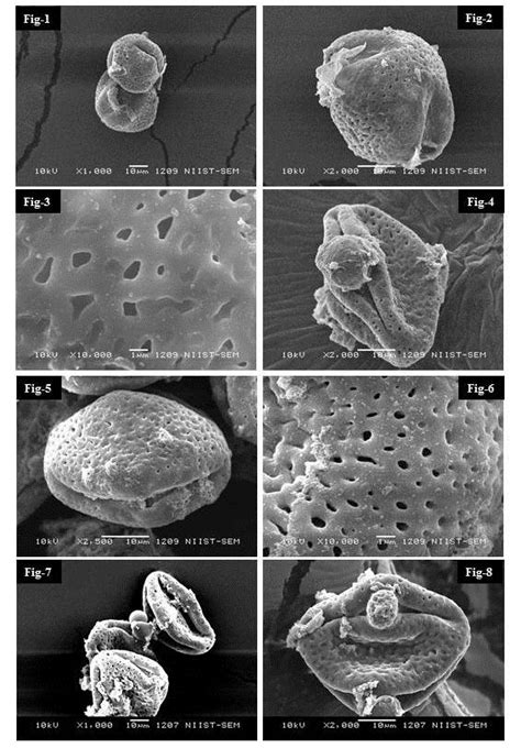 Leea Asiatica L Ridsdale Pollen 1000x 2000x 10000x Figs 4 6 Download Scientific