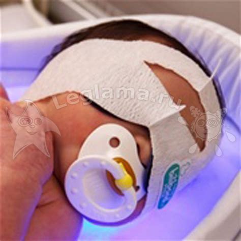 Маска для фототерапии Billiband Premature (средняя)