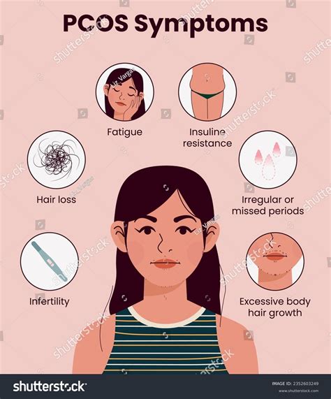 Illustration Of Pcos Symptoms Concept Woman Royalty Free Stock