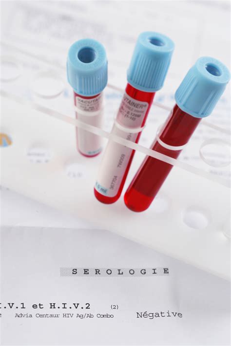 Sex roulette parties where one person secretly has HIV are happening