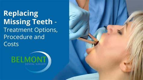 Replacing Missing Teeth Treatment Options