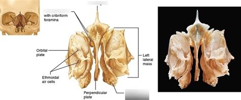 Ethmoid Bone Diagram | Quizlet