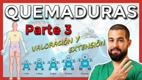 Quemaduras Parte C Mo Calcular La Extensi N De Una Quemadura De