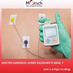 Ideias De Holter De Ecg Digital Horas Prontu Rio Eletr Nico