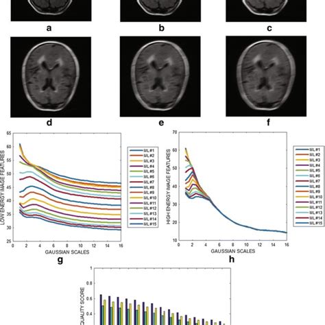 A Flair Brain Mri Slice From Adni And Its Degraded Versions At Motion