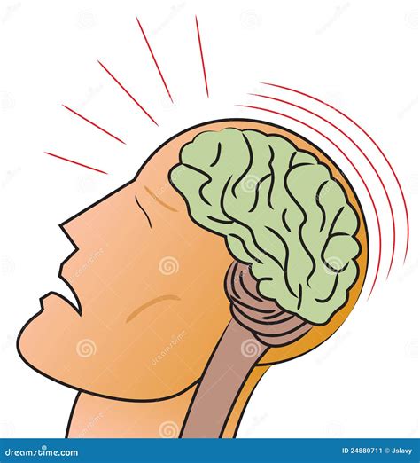 Concussion Stock Illustrations – 868 Concussion Stock Illustrations