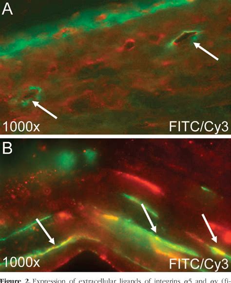 Figure 2 From Inhibition Of Inflammatory Lymphangiogenesis By Integrin