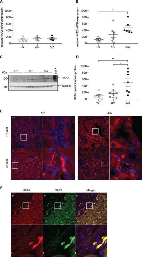 H⁺k⁺ Atpase Type 2 Expression Is Increased In Cap2tmprss4 Mice On Low