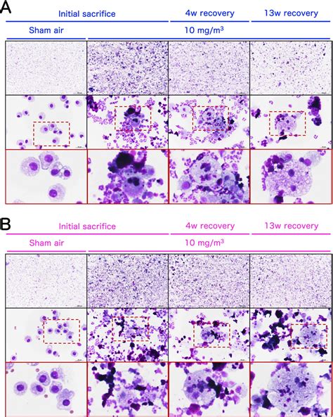 Representative Images Of The Bronchoalveolar Lavage Fluid Balf