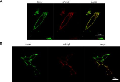 Confocal Images Of Hek Cells Transiently Transfected With A Fret