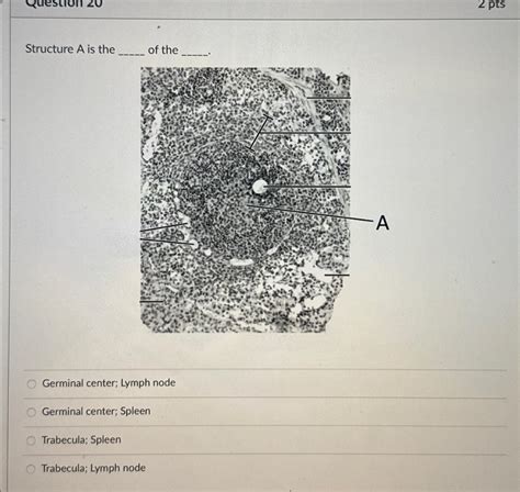 Solved Structure A is the of theGerminal center; Lymph | Chegg.com