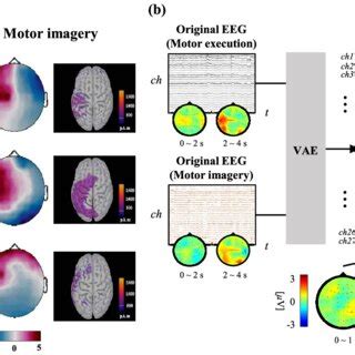 Neurophysiological Analysis Using Spatial Distribution A