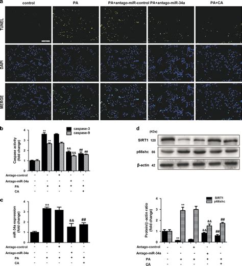 Ca Exerts An Antiapoptotic Effect Through The Mir 34a Sirt1 P66shc