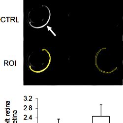 Chromium Cr Enhanced Mri Of The Retina In The Streptozotocin Stz