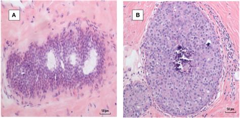 A Mouse Mammary Tumor Virus Mmtv Positive By Polymerase Chain