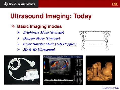 Ppt Ultrasound Imaging Powerpoint Presentation Free Download Id 3309253