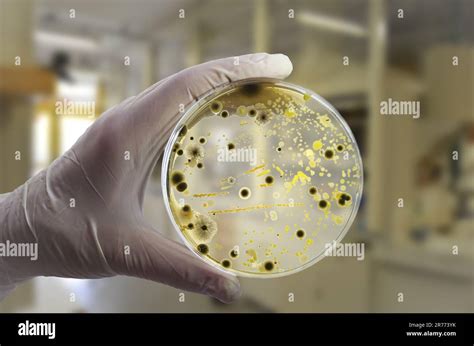 Colonies Of Different Bacteria And Mold Fungi Grown On Petri Dish With