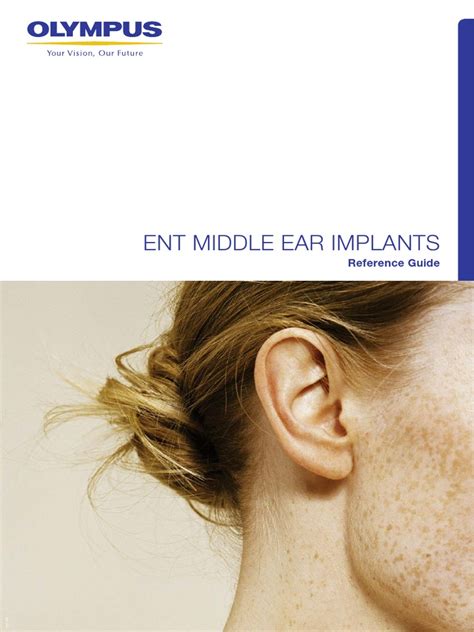 Middle Ear Implants Reference Guide | PDF | Prosthesis | Implant (Medicine)