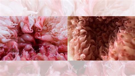 Pics Show A Vagina Under A Microscope Snopes