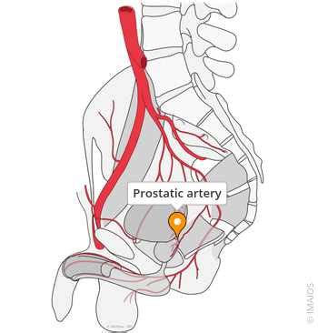 prostatic artery  anatomy imaios