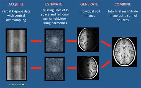 Grappaarc Questions And Answers In Mri