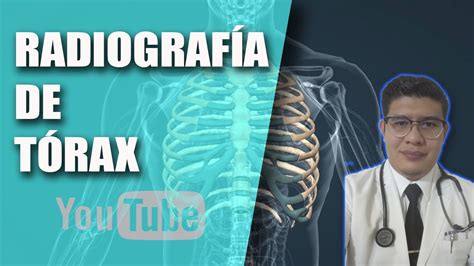 Radiograf A De T Rax T Cnica Youtube