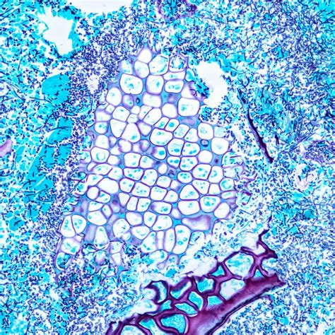 pathologyoutlinescom logo brand assets svg png  vector