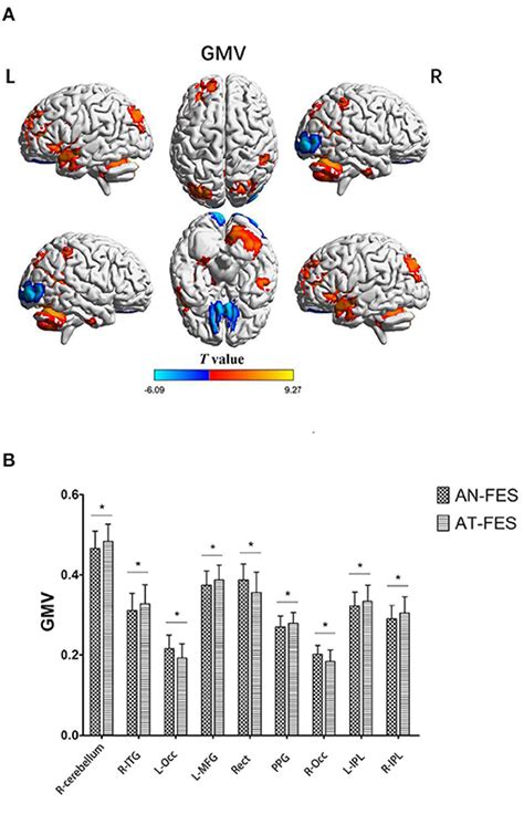 Frontiers Changes In Brain Structure Function And Network