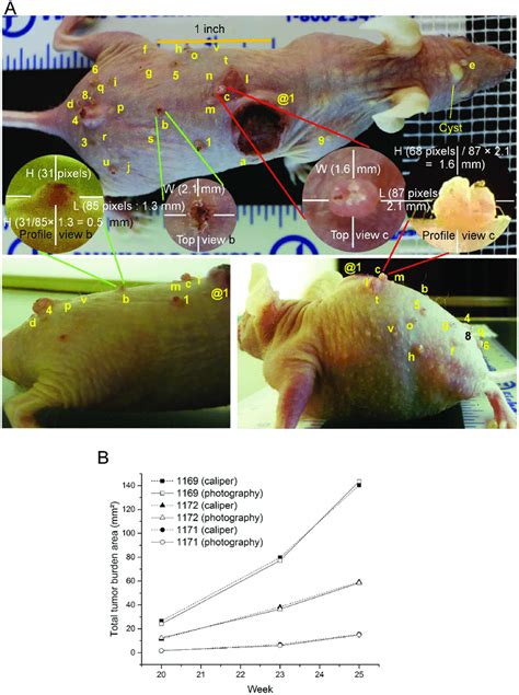 Measurement Of Tumor Dimensions And Total Tumor Burden In Mice By Two