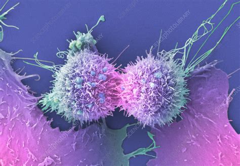 Cervical Cancer Cells Dividing SEM Stock Image C059 3631 Science