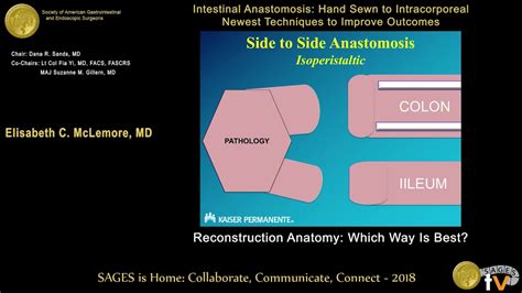 Colocolonic Anastomosis - Colon Rectum And Anus Basicmedical Key _ Mild ...