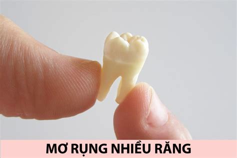 Nằm Mơ Nhổ Răng Là điểm Báo Lành Hay Dữ đánh Con Gì