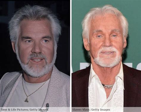 Kenny Rogers Before And After Plastic Surgery Cut Me Pinterest