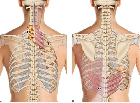 Muscles Du Rachis Et De La Cage Thoracique Medicine Key